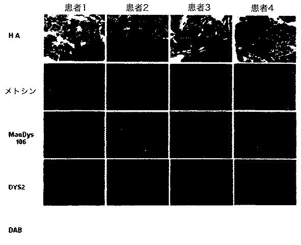 5879374-筋障害を相殺するための手段と方法 図000019