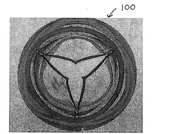 6038018-流れに最適化したポリマー心臓弁 図000019