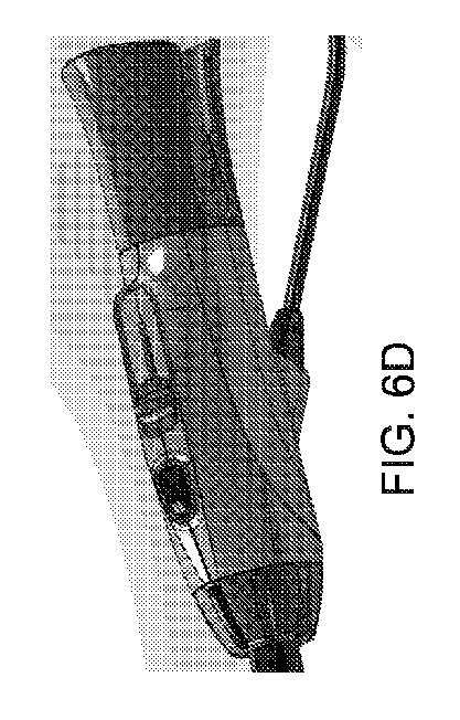 6283091-単一の内視鏡用管採取デバイス 図000019