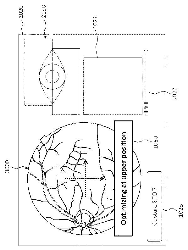 6321430-眼科装置 図000019
