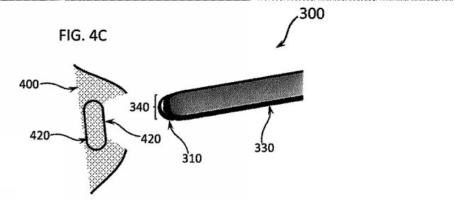 6580038-軟組織切開するための方法及び装置 図000019