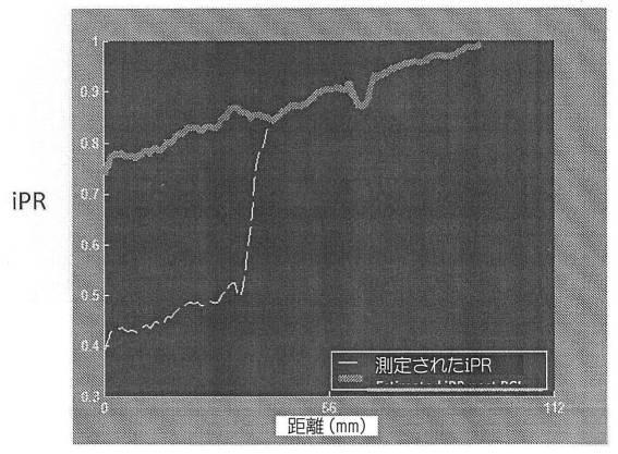 6736245-流体で満たされた管内の狭窄部の特徴を描写するシステムおよびその動作方法 図000019