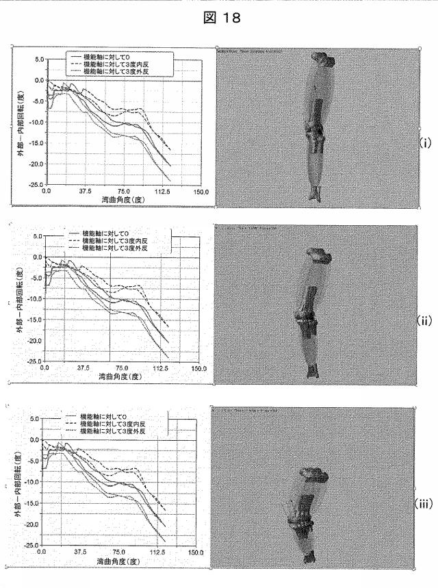 6979445-患者の関節用の整形外科インプラントの位置合わせをモデル化するためのコンピュータ装置の作動方法およびコンピュータ装置 図000019