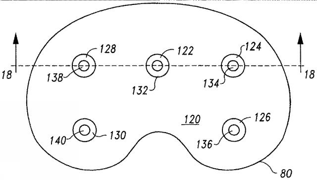 5916989-異なる質感を有する表面を備えた人工関節及びその人工関節の作製方法 図000020