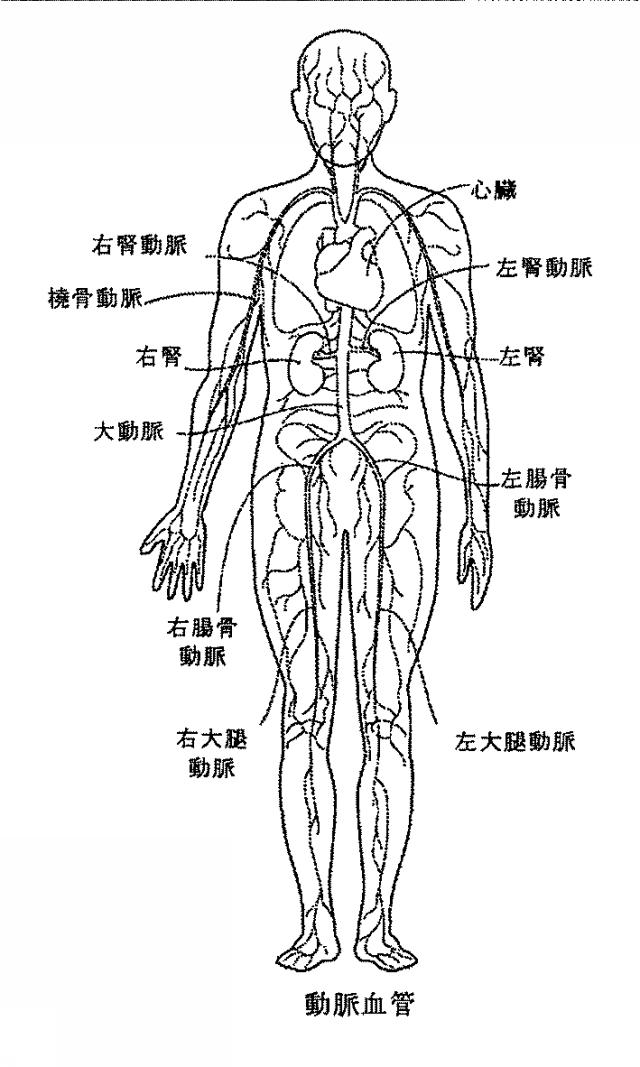 6267774-神経変調療法の評価及びフィードバックのためのデバイス、システム、及び方法 図000020