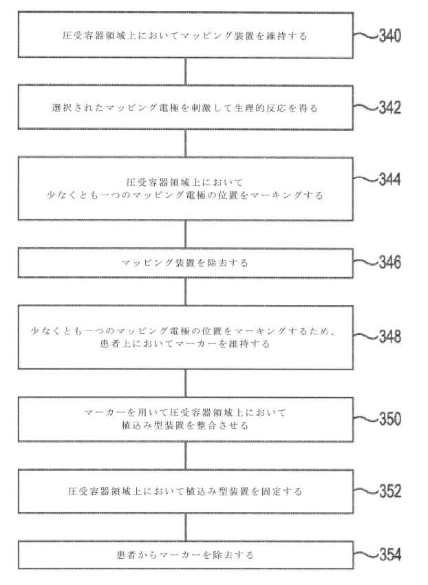 6306742-圧受容器マッピングシステム 図000020