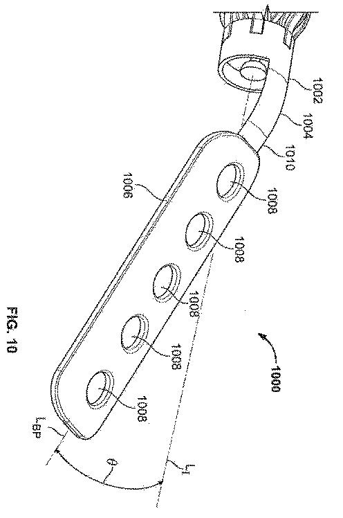 6316876-骨インプラントを固定するための装置および方法 図000020