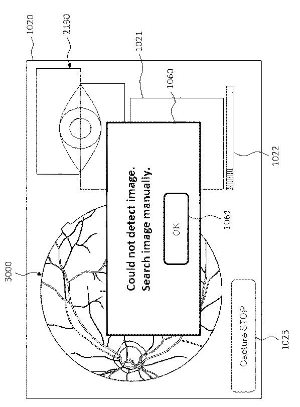 6321430-眼科装置 図000020