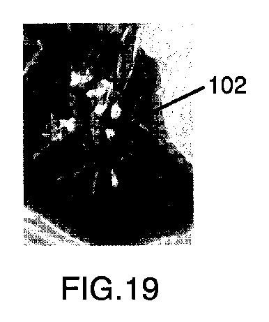 6396310-第一レンダリング投影と第二レンダリング投影との間のトランジションをユーザーに表示するための方法および装置 図000020