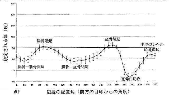 6525582-股関節の面再建 図000020