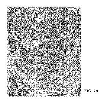 6843062-ＣＡＲ  Ｔ細胞免疫療法のための新規標的としてのＨＬＡ−Ｇ 図000020