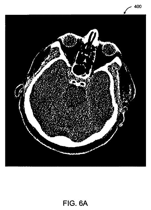 5753791-ノイズ除去された所定の解像度の医療画像を提供する方法、所定の解像度のノイズ除去された所定の解像度の医療画像を提供するシステム 図000021