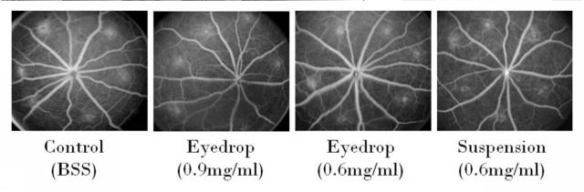 6099209-黄斑変性の予防または治療用の医薬組成物 図000021