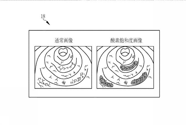6254502-内視鏡用光源装置及び内視鏡システム 図000021