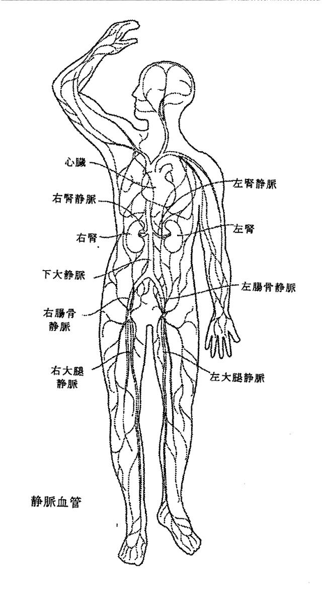 6267774-神経変調療法の評価及びフィードバックのためのデバイス、システム、及び方法 図000021