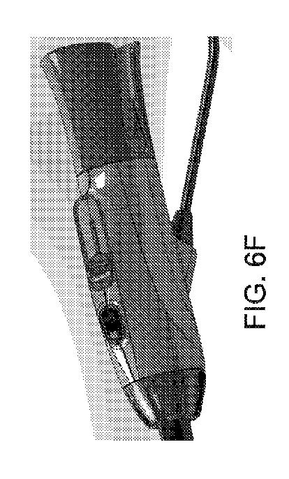 6283091-単一の内視鏡用管採取デバイス 図000021