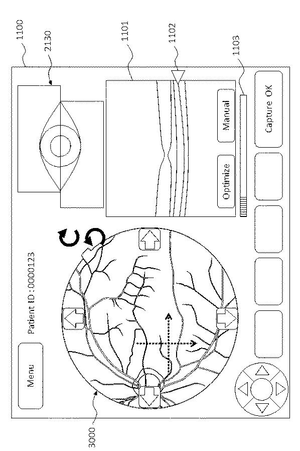 6321430-眼科装置 図000021