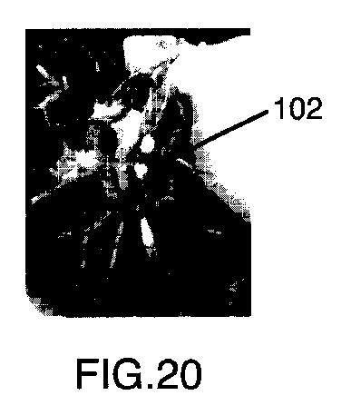 6396310-第一レンダリング投影と第二レンダリング投影との間のトランジションをユーザーに表示するための方法および装置 図000021