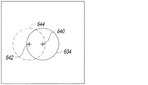 6433665-オフセットを設定するための脛骨の整形外科用手術器具 図000021