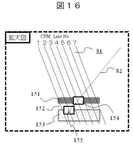 6444519-超音波診断装置、及び超音波撮像方法 図000021