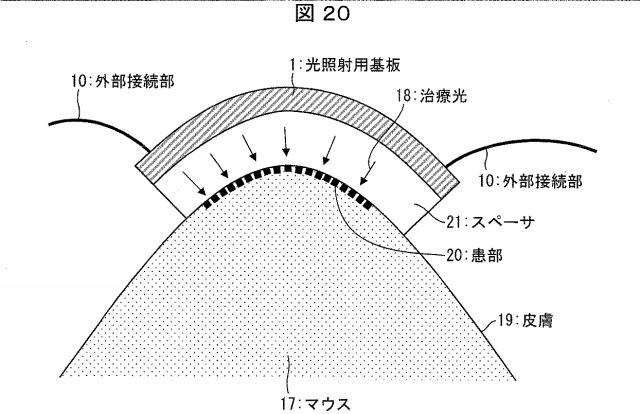 6445187-光照射装置および光治療器 図000021