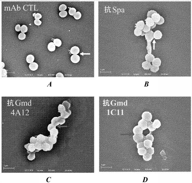 6559302-黄色ブドウ球菌（Ｓｔａｐｈｙｌｏｃｏｃｃｕｓ  ａｕｒｅｕｓ）感染症に対する抗グルコサミニダーゼ受動免疫処置 図000021