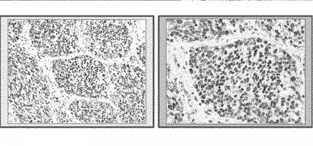 6609867-癌治療薬剤ならびに治療方法 図000021