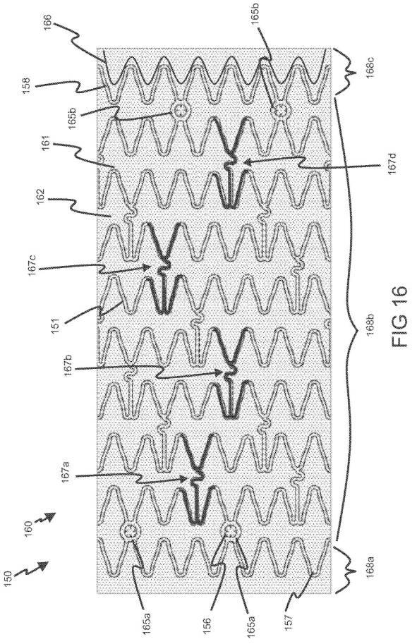 6793147-動脈瘤を治療するためのデバイスおよび方法 図000021