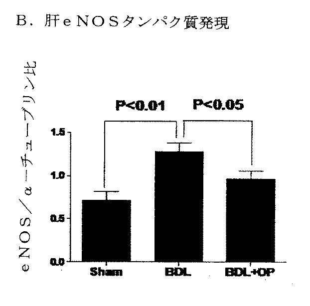 5749255-Ｌ−オルニチンフェニル酢酸塩を用いる門脈圧亢進の治療及び肝機能の修復 図000022