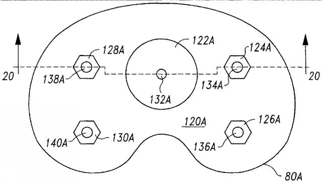 5916989-異なる質感を有する表面を備えた人工関節及びその人工関節の作製方法 図000022