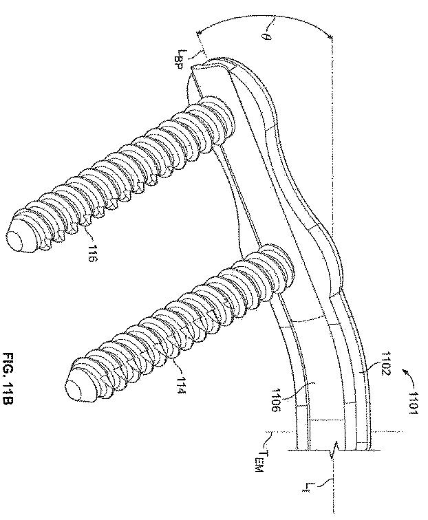 6316876-骨インプラントを固定するための装置および方法 図000022