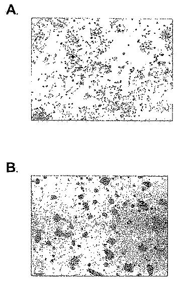 6383743-ＥＲＧ遺伝子発現における前立腺癌特異的変化ならびにそれらの変化に基づく検出および治療方法 図000022