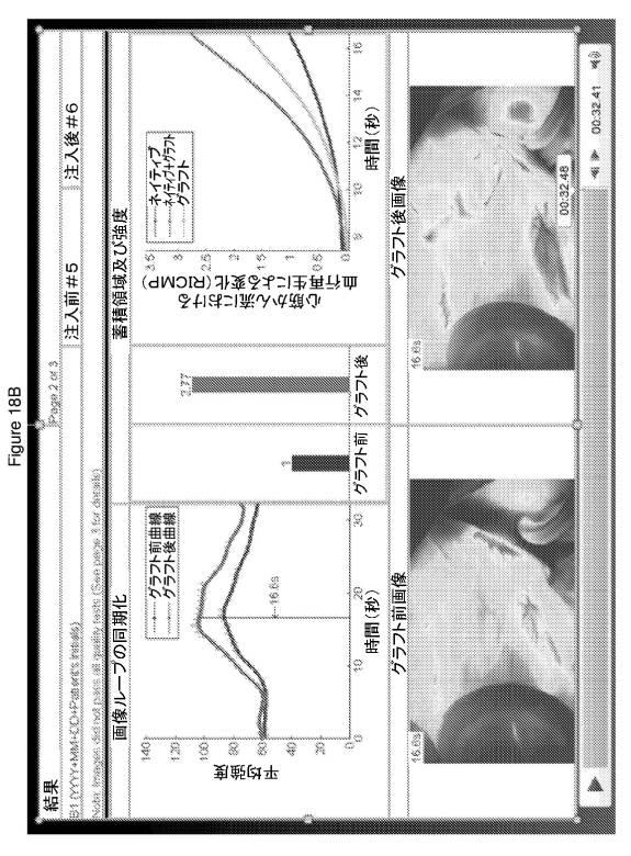 6561180-血管造影及びかん流の定量化並びに解析手法 図000022