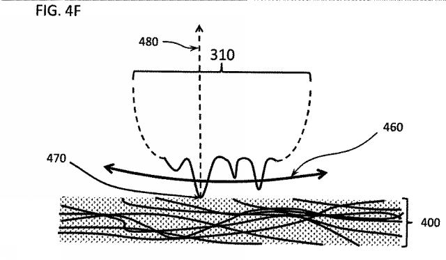 6580038-軟組織切開するための方法及び装置 図000022