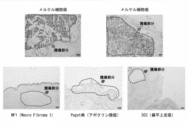 6609867-癌治療薬剤ならびに治療方法 図000022