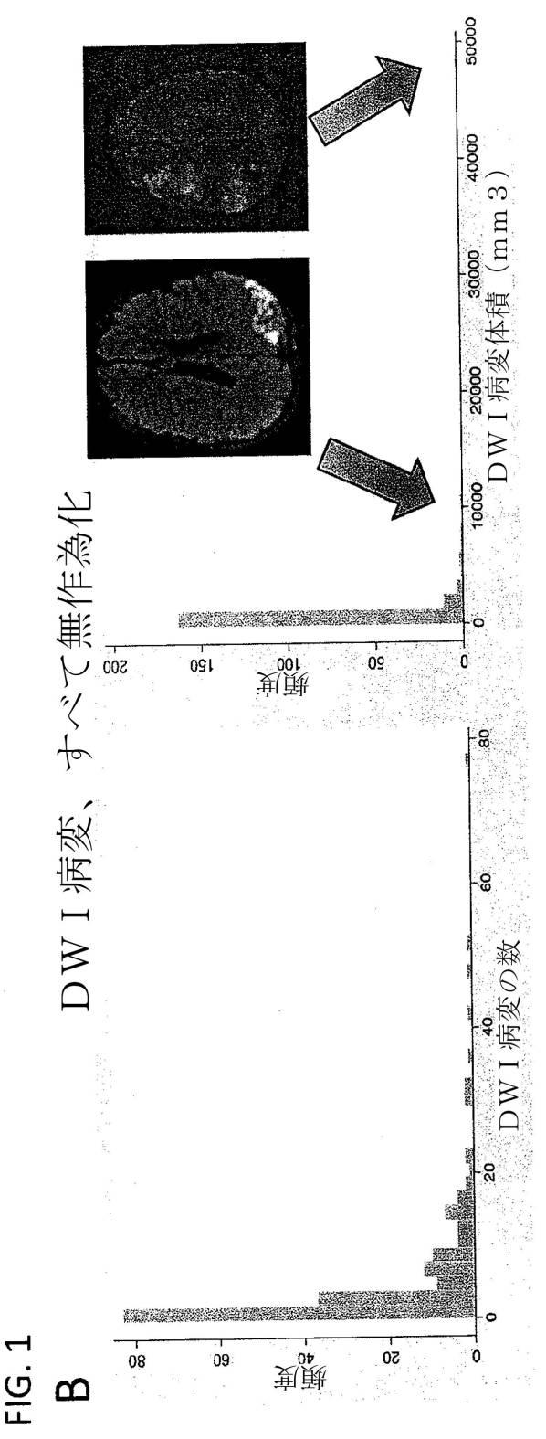 6741642-くも膜下出血および虚血の治療法 図000022