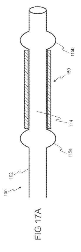 6793147-動脈瘤を治療するためのデバイスおよび方法 図000022