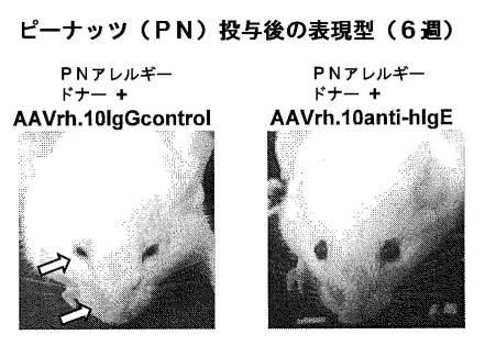 6878301-アレルゲンに対する反応を予防するための遺伝子治療 図000022