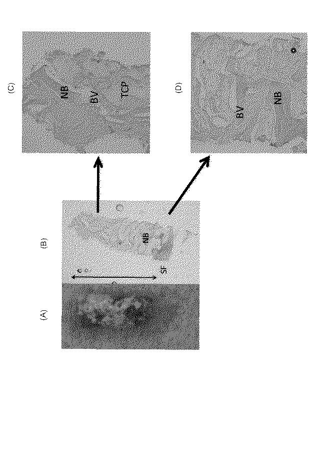 6010112-不死化幹細胞及びその産生物を有効成分とする医薬組成物並びに医薬製剤 図000023