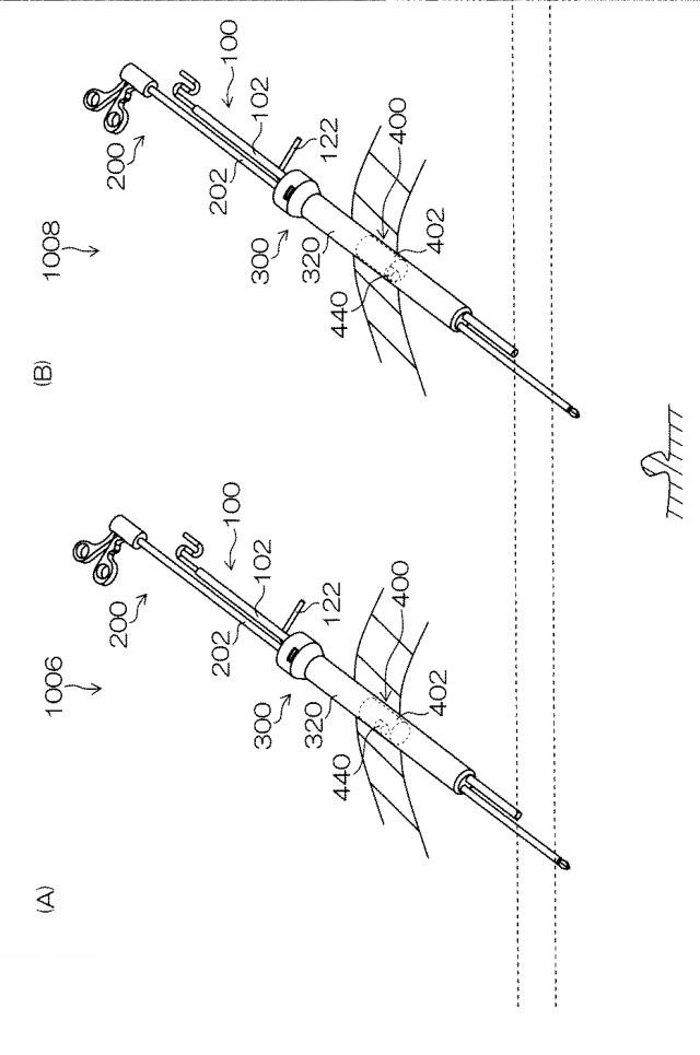 6082469-内視鏡下外科手術装置及び外套管 図000023