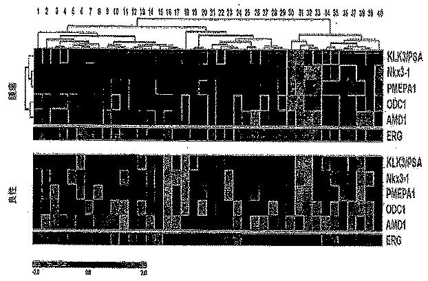 6383743-ＥＲＧ遺伝子発現における前立腺癌特異的変化ならびにそれらの変化に基づく検出および治療方法 図000023