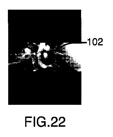 6396310-第一レンダリング投影と第二レンダリング投影との間のトランジションをユーザーに表示するための方法および装置 図000023