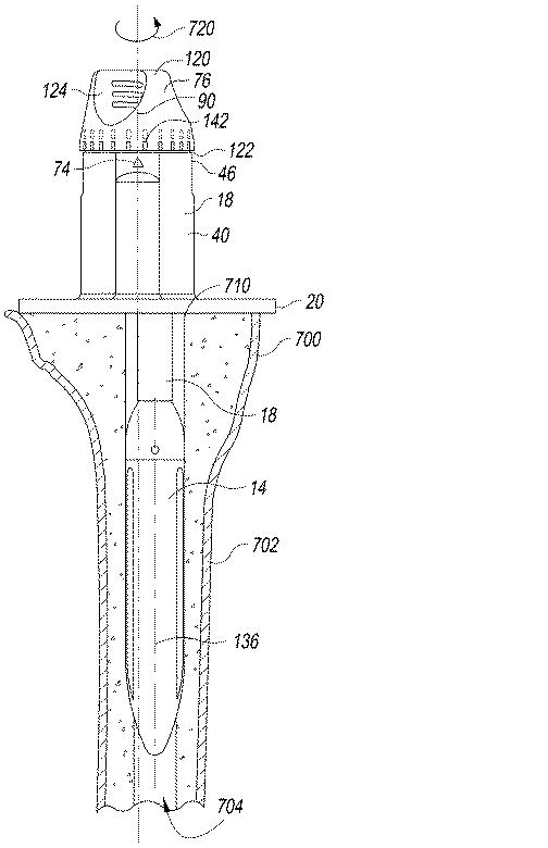 6433665-オフセットを設定するための脛骨の整形外科用手術器具 図000023