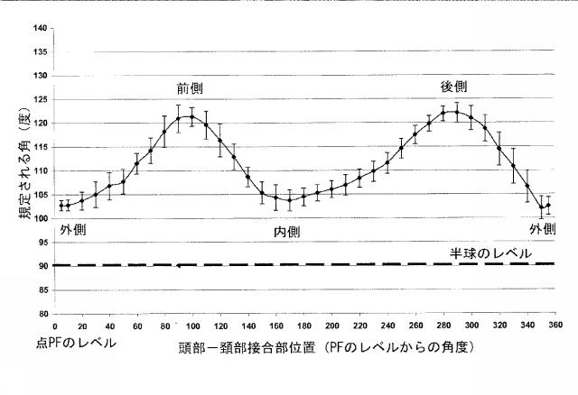 6525582-股関節の面再建 図000023