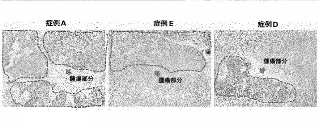 6609867-癌治療薬剤ならびに治療方法 図000023