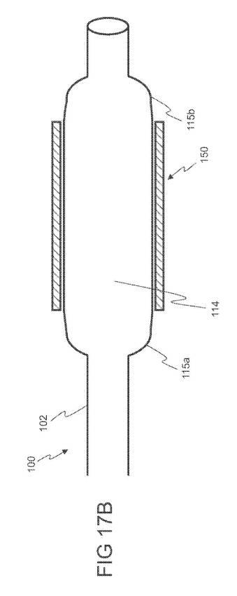 6793147-動脈瘤を治療するためのデバイスおよび方法 図000023