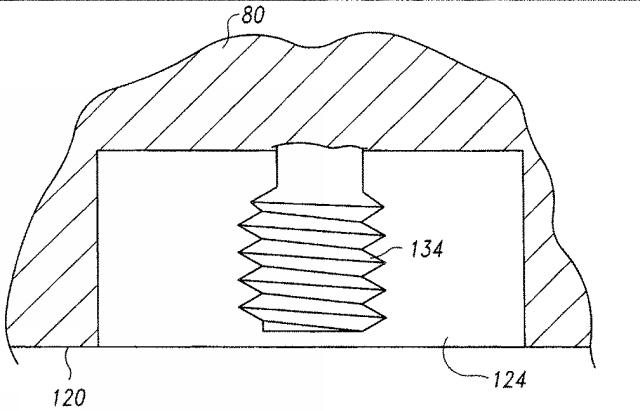 5916989-異なる質感を有する表面を備えた人工関節及びその人工関節の作製方法 図000024