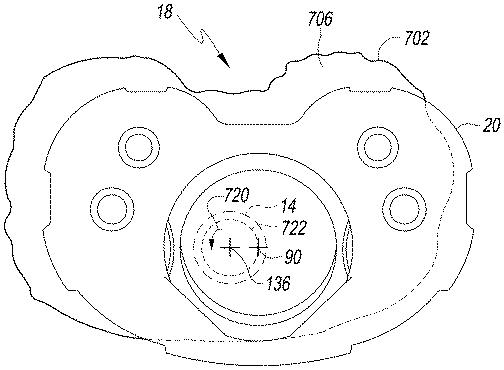 6433665-オフセットを設定するための脛骨の整形外科用手術器具 図000024