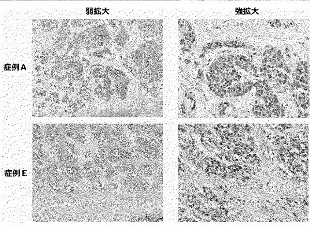 6609867-癌治療薬剤ならびに治療方法 図000024