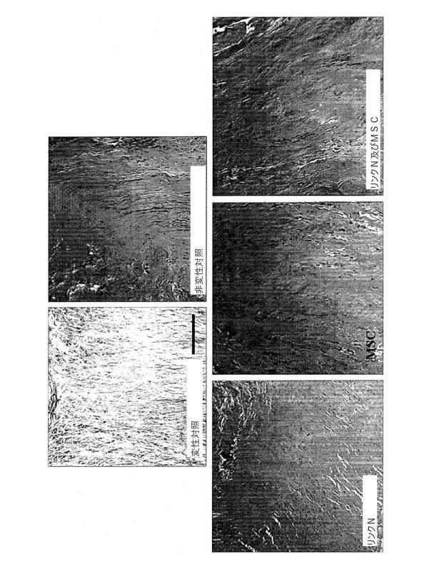 6700182-軟骨及び椎間板組織病理の治療のためのポリペプチド及び組成物 図000024